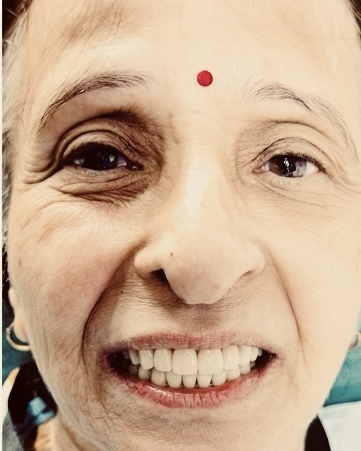 Full-mouth rehabilitation &mdash; after treatment