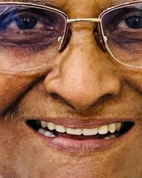 Full-Mouth Rehabilitation — after treatment