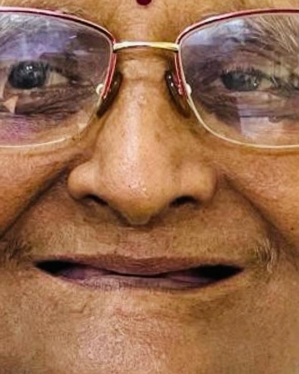 Full-Mouth Rehabilitation — before treatment
